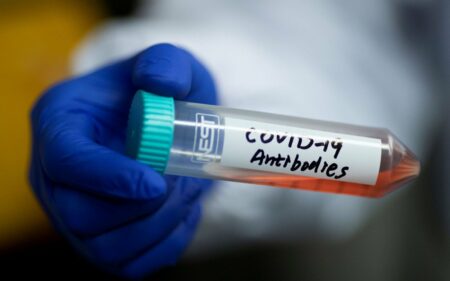 Pengobatan antibodi untuk Covid-19