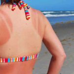 Cara memilih dan memakai sunscreen dengan benar
