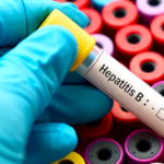 gejala hepatitis b